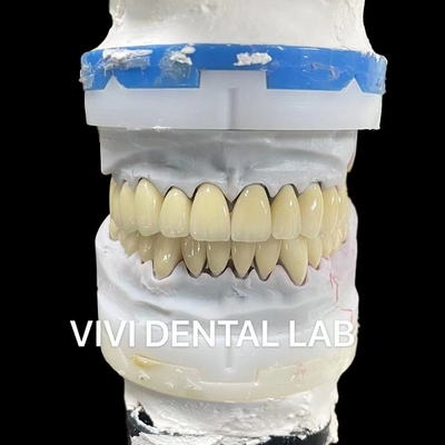 中国 VIVI DENTAI LABORATORY 認証