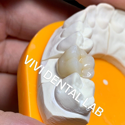 固体歯科実験室は完全なジルコニアが中国の歯科実験室を戴冠させる3Dプロ高い半透明を戴冠させる
