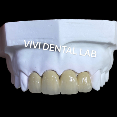 中国 VIVI DENTAI LABORATORY 認証