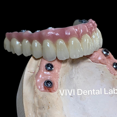 中国 VIVI DENTAI LABORATORY 認証