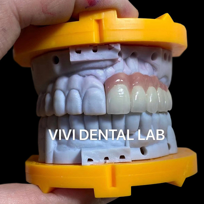 中国 VIVI DENTAI LABORATORY 認証