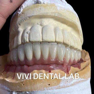 中国 VIVI DENTAI LABORATORY 認証