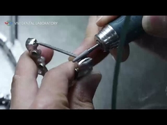 PFM クローナとブリッジ