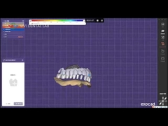 デジタル 入れ歯