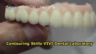 形状輪郭技術 VIVI Dental Laboratory 中国