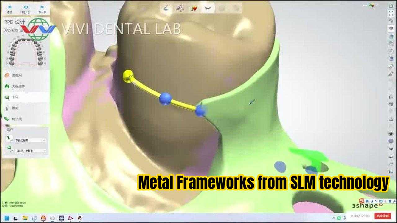 中国 VIVI DENTAI LABORATORY 認証